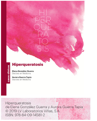 Hiperqueratosis